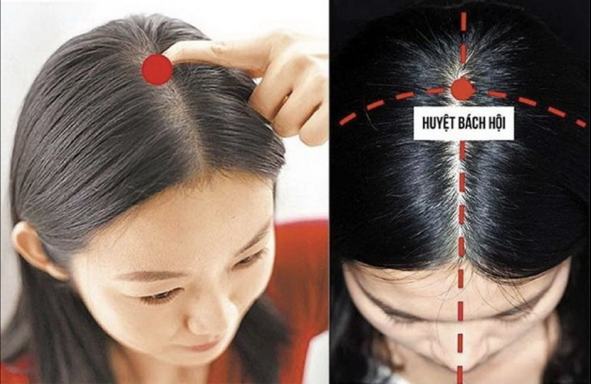 Chuyên gia Đông y chỉ cách bấm huyệt chữa đau đầu, không cần dùng thuốc mà vẫn hiệu quả - Ảnh 1